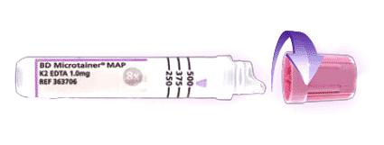 Image: The Microtainer MAP Microtube for Automated Process for hematology testing (photo courtesy BD Diagnostics).